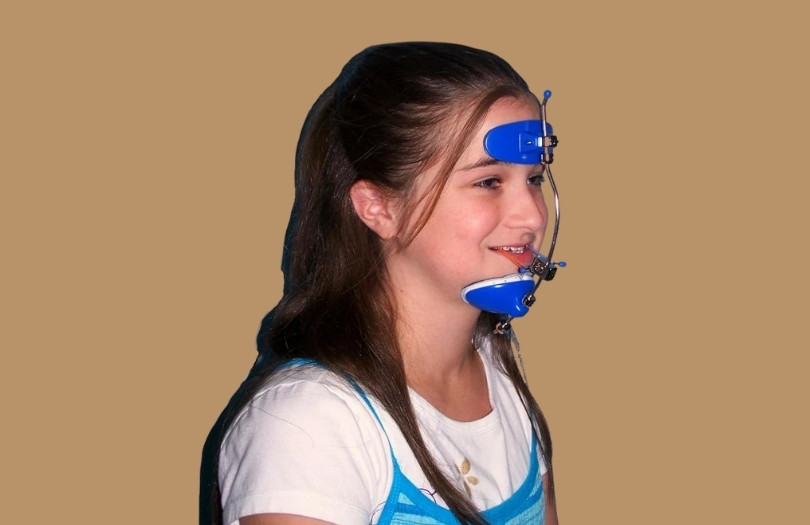 Dr. ozlem aylikci Drozlemorto Dis Teli Uzmani Hareketli ortodonti facemask 1
