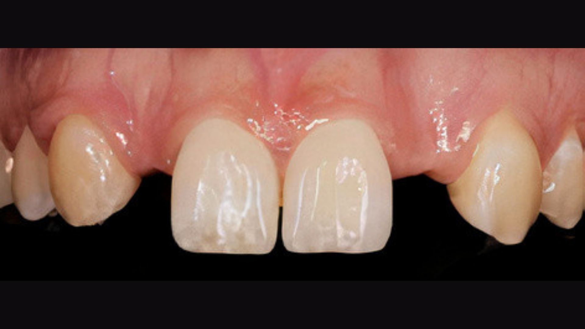 implant vakalari 3 Dr. Bahadir Ugur Aylikci Ortodonti Uzmani Dr. Ozlem Aylikci 1 1