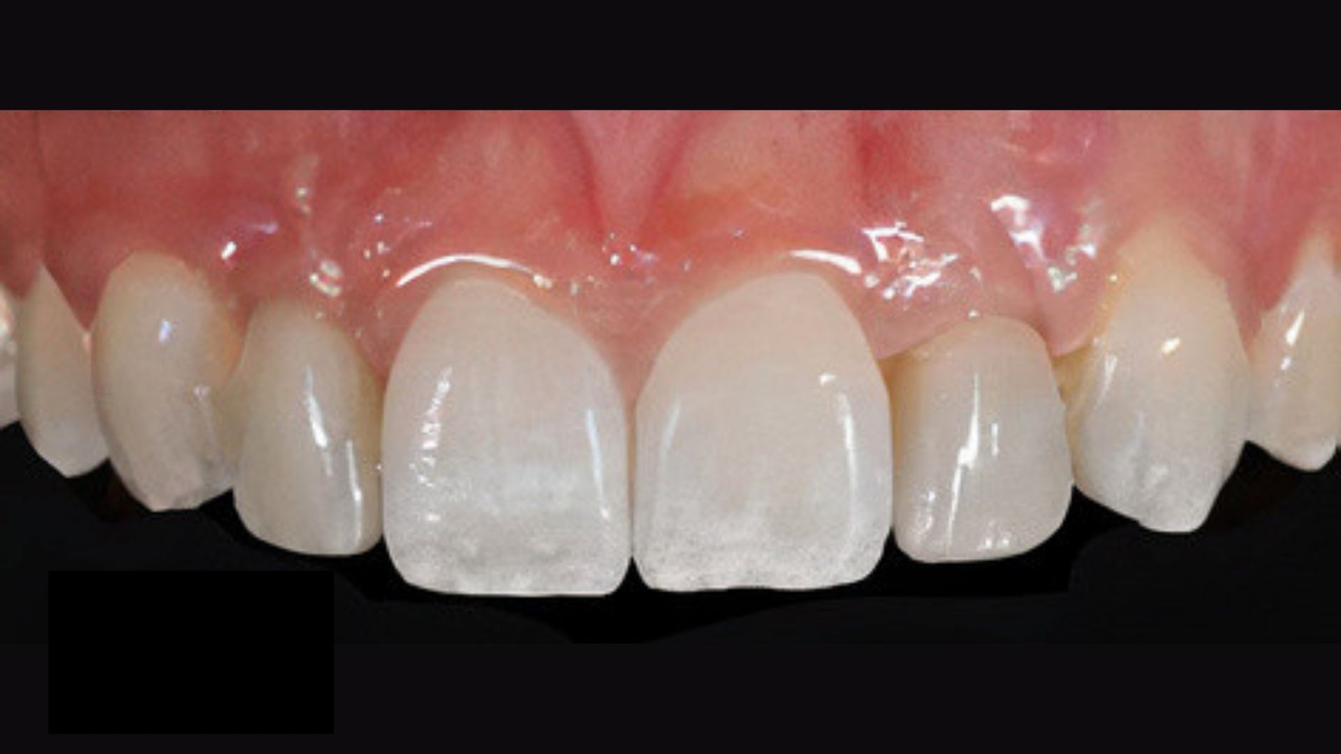 implant vakalari 4 Dr. Bahadir Ugur Aylikci Ortodonti Uzmani Dr. Ozlem Aylikci 1 1