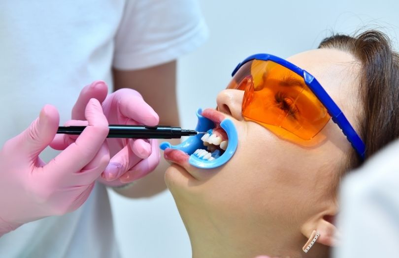 Dr. Ozlem Aylikci Drozlemorto Gulus Tasarim Uzmani dr. Bahadir Ugur Aylikci Dis beyazlatma Bleaching dis eti bariyeri 1